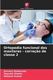 Ortopedia funcional dos maxilares - correção de classe 2