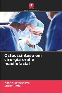 Osteossíntese em cirurgia oral e maxilofacial - Srivastava, Rachit;Jindal, Lucky