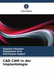 CAD CAM in der Implantologie