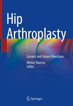 Cover Hip Arthroplasty (eBook, PDF)