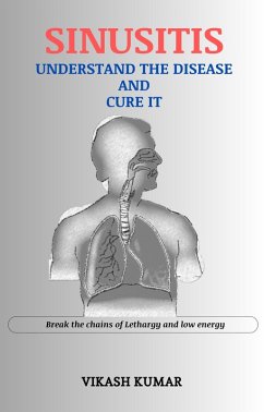 Sinusitis : Understand the disease and cure it (eBook, ePUB) - Kumar, Vikash