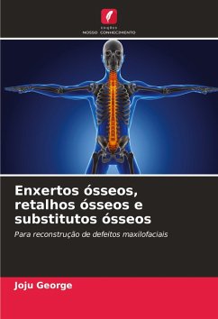Cover Enxertos ósseos, retalhos ósseos e substitutos ósseos