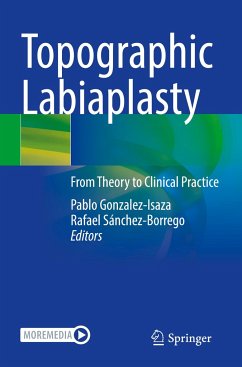 Topographic Labiaplasty