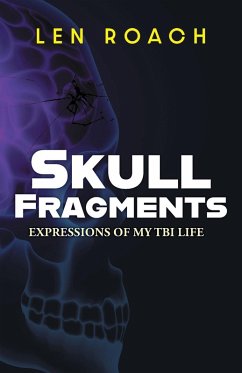 Skull Fragments