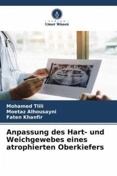 Anpassung des Hart- und Weichgewebes eines atrophierten Oberkiefers - Tlili, Mohamed;Alhousayni, Moetaz;Khanfir, Faten