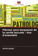 Fibrose sous-muqueuse de la cavité... - Bild 1