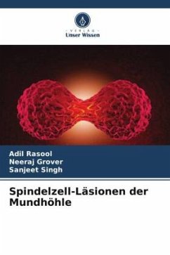 Spindelzell-Läsionen der Mundhöhle - Rasool, Adil;Grover, Neeraj;Singh, Sanjeet