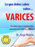 Lo que debes saber sobre... Varices (La Medicina hecha fácil - Medicine Made Easy, #1) (eBook, ePUB)