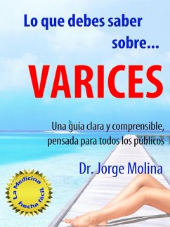 Cover Lo que debes saber sobre... Varices (La Medicina hecha fácil - Medicine Made Easy, #1) (eBook, ePUB)