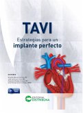 TAVI - Estrategias para un implante perfecto (eBook, ePUB) TAVI - Estrategias para un implante perfecto (eBook, ePUB)
