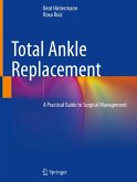 Total Ankle Replacement