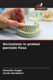 Occlusione in protesi parziale fissa