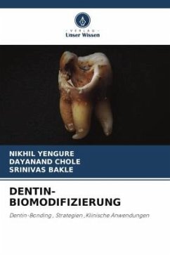 DENTIN-BIOMODIFIZIERUNG - Yengure, Nikhil;Chole, Dayanand;Bakle, Srinivas