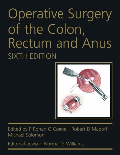 Operative Surgery of the Colon, Rectum and Anus (eBook, ePUB) - O'Connell, P Ronan; Madoff, Robert D.; Solomon, Michael