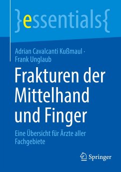 Frakturen der Mittelhand und Finger - Cavalcanti Kußmaul, Adrian;Unglaub, Frank