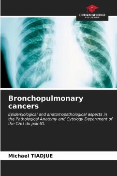 Bronchopulmonary cancers - TIADJUE, Michael