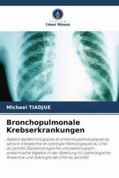 Bronchopulmonale Krebserkrankungen - TIADJUE, Michael