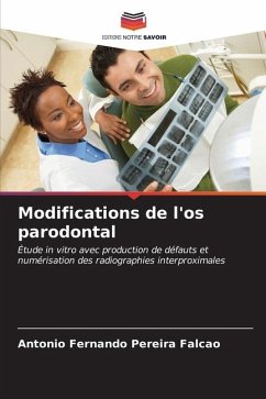 Modifications de l'os parodontal - Pereira Falcão, Antonio Fernando