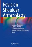 Revision Shoulder Arthroplasty (eBook, PDF)