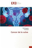 Cancer de la vulve