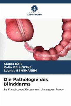 Die Pathologie des Blinddarms - Hail, Kamel;Belhocine, Kafia;Benghanem, Lounas