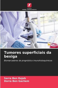 Tumores superficiais da bexiga - BEN REJEB, SARRA;Ben Gachem, Dorra