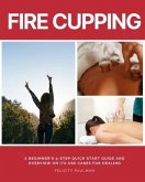 Fire Cupping (eBook, ePUB)