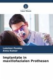 Implantate in maxillofazialen Prothesen