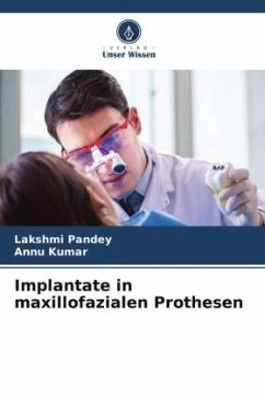 Implantate in maxillofazialen Prothesen - Pandey, Lakshmi;Kumar, Annu