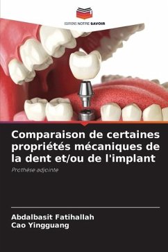 Comparaison de certaines propriétés mécaniques de la dent et/ou de l'implant - Fatihallah, Abdalbasit;Yingguang, Cao