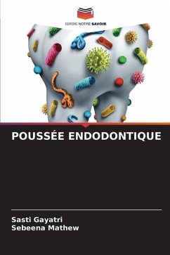 POUSSÉE ENDODONTIQUE - Gayatri, Sasti;Mathew, Sebeena