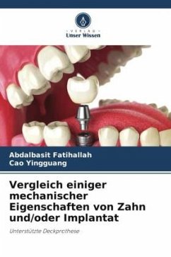 Vergleich einiger mechanischer Eigenschaften von Zahn und/oder Implantat - Fatihallah, Abdalbasit;Yingguang, Cao