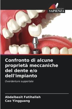 Confronto di alcune proprietà meccaniche del dente e/o dell'impianto - Fatihallah, Abdalbasit;Yingguang, Cao