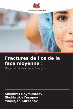 Fractures de l'os de la face moyenne : - Boymuradov, Shukhrat;Yusupov, Shokhrukh;Kurbonov, Yoqubjon