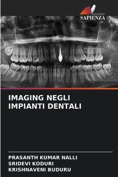 IMAGING NEGLI IMPIANTI DENTALI - NALLI, PRASANTH KUMAR;Koduri, Sridevi;Buduru, Krishnaveni