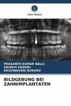 BILDGEBUNG BEI ZAHNIMPLANTATEN - NALLI, PRASANTH KUMAR;Koduri, Sridevi;Buduru, Krishnaveni