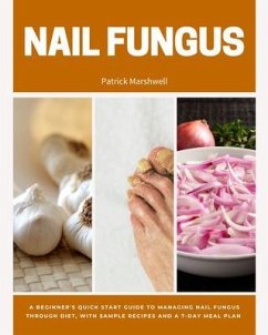 Nail Fungus (eBook, ePUB) - Marshwell, Patrick