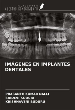 Cover IMÁGENES EN IMPLANTES DENTALES