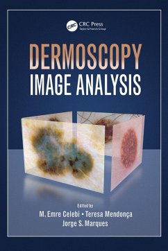 Cover Dermoscopy Image Analysis (eBook, ePUB)