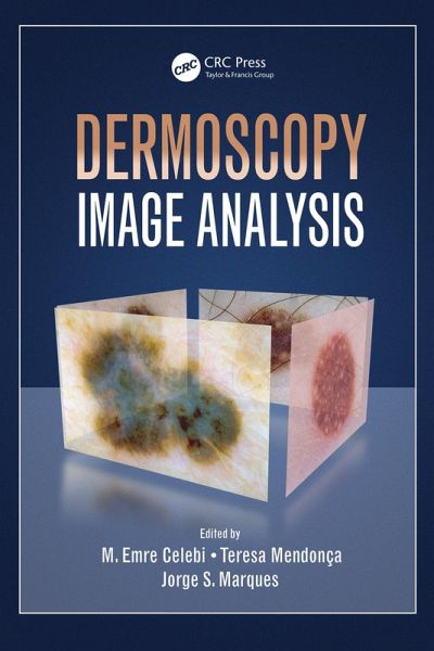 Dermoscopy Image Analysis (eBook, ePUB)