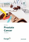 Fast Facts: Prostate Cancer (eBook, ePUB)