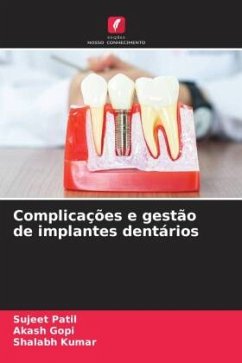 Complicações e gestão de implantes dentários - Patil, Sujeet;Gopi, Akash;Kumar, Shalabh