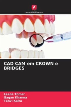 CAD CAM em CROWN e BRIDGES - Tomer, Leena;Khanna, Gagan;Kalra, Tanvi