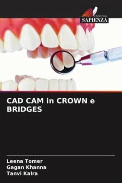 CAD CAM in CROWN e BRIDGES - Tomer, Leena;Khanna, Gagan;Kalra, Tanvi