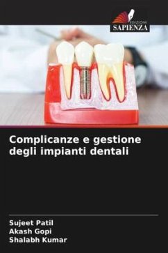 Complicanze e gestione degli impianti dentali - Patil, Sujeet;Gopi, Akash;Kumar, Shalabh