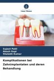 Komplikationen bei Zahnimplantaten und deren Behandlung