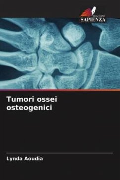 Tumori ossei osteogenici - Aoudia, Lynda
