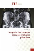 Imagerie des tumeurs osseuses malignes primitives