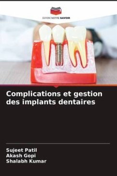 Complications et gestion des implants dentaires - Patil, Sujeet;Gopi, Akash;Kumar, Shalabh