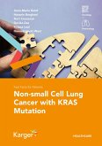 Fast Facts for Patients: Non-small Cell Lung Cancer with KRAS Mutation (eBook, ePUB)